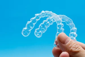 Nakładki Invisalign czy warto